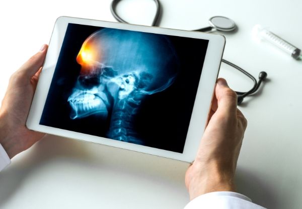 Paraná Registra Queda Geral nos Casos de Meningite, Mas Disparo da Doença Meningocócica Ameaça Saúde Pública