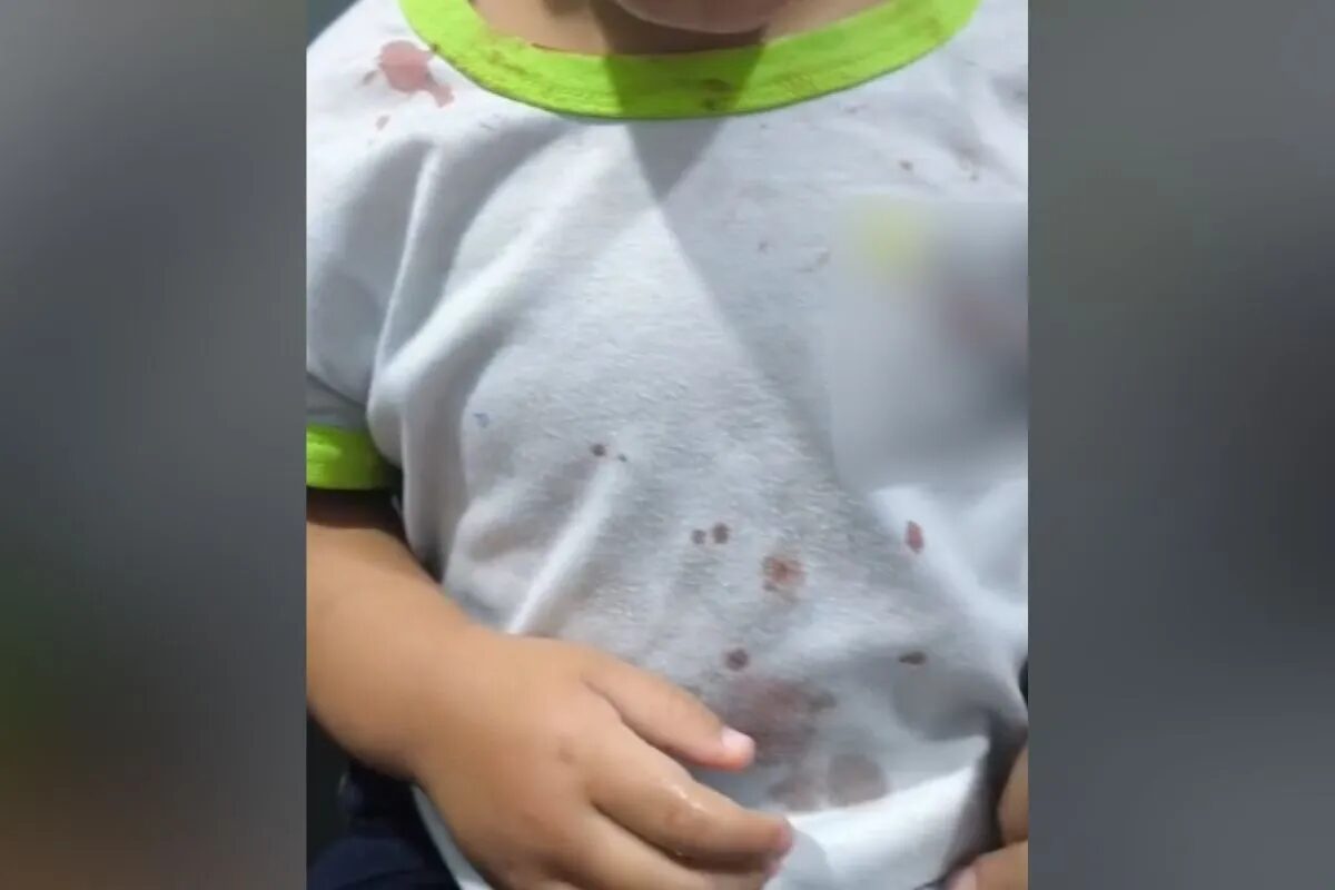 Justiça mantém preso padrasto de 2 anos agredida